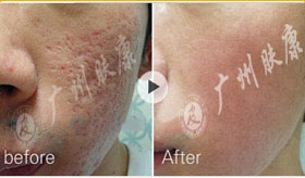 ���ݷ���Ƥ����ҽԺ